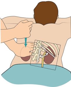 lymphatic drainage in berlin 1